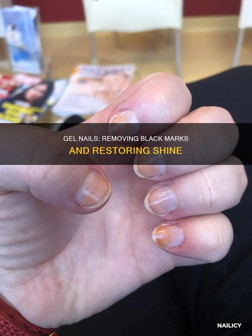 how to remove black marks on gel nails