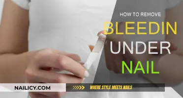 Relieving Pain: Stop Bleeding Under Your Nails