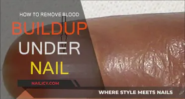 Treating Blood Buildup Under Nails: Quick Home Remedies