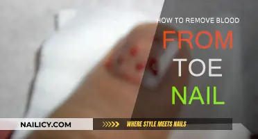 Effective Ways to Remove Blood from Under Your Toenail