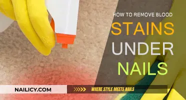 Erase Blood Stains Under Nails Easily