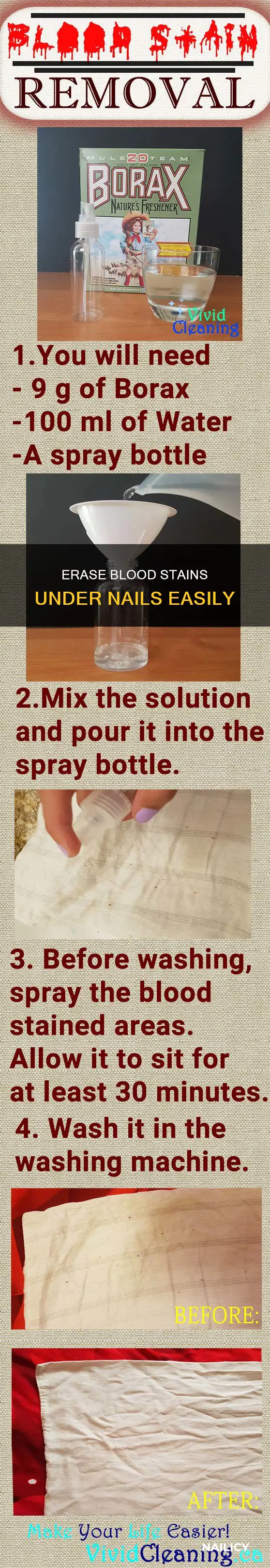 how to remove blood stains under nails