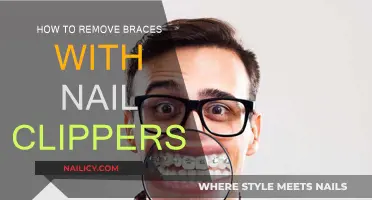 Clipper Conundrum: Removing Braces at Home