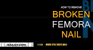 Removing a Broken Femoral Nail: A Step-by-Step Guide