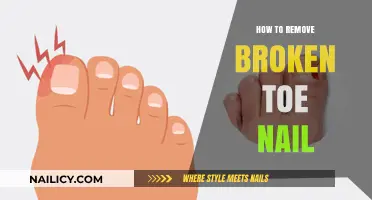 Removing a Broken Toenail: A Step-by-Step Guide