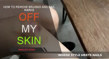 Erase Bruises and Nail Marks: Quick Skin Solutions