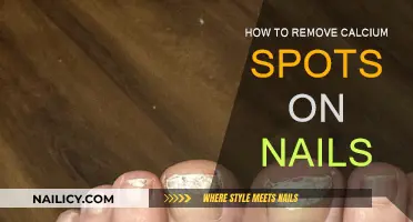 Get Rid of Calcium Spots on Nails