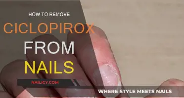 Eradicating Ciclopirox: Effective Nail Treatment and Removal