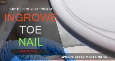 Relief from Ingrown Toenails: Easy Corner Removal