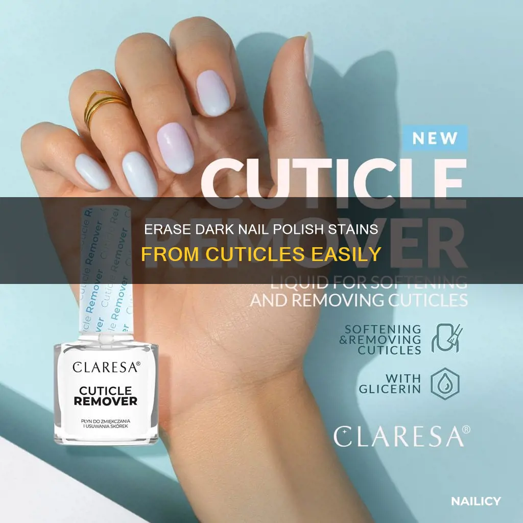 how to remove dark nail polish from cuticles