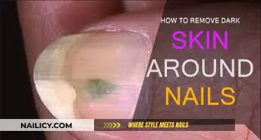 Erase Dark Skin Around Nails Easily