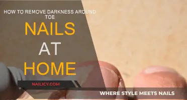 Erase Dark Toenails: Home Remedies That Work