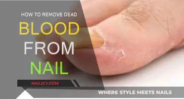 Get Rid of Blood Under Your Nails