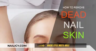 Get Rid of Dead Nail Skin: Easy Home Remedies