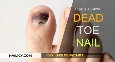 Effective Methods to Remove Dead Toenails at Home