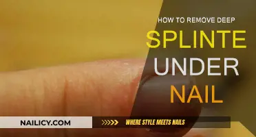 Efficient Splinter Removal: Under Nails