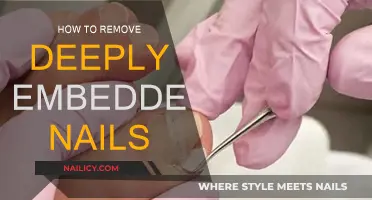 Removing Embedded Nails: A Safe and Easy Guide