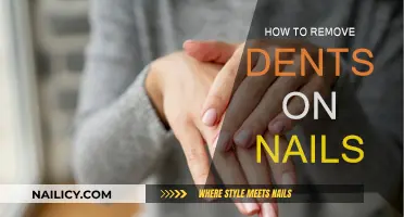 Easy Ways to Fix Nail Dents at Home