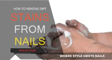 Get Rid of Nail Dirt Stains Easily