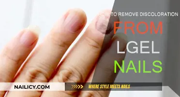 Get Rid of Discolored Nails: Gel Nails Edition