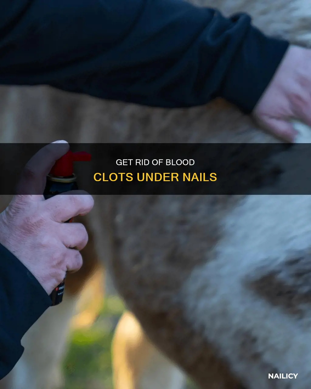 how to remove dried blood clot under nail