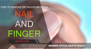 Quickly Remove Dry Blood from Under Your Nails