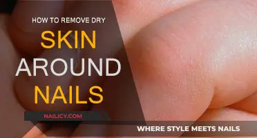 Get Rid of Dry Skin Around Nails