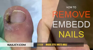 Removing Embedded Nails: A Step-by-Step Guide