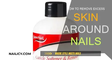 Get Rid of Excess Skin Around Nails
