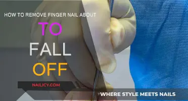 Quickly Remove a Fingernail About to Fall Off