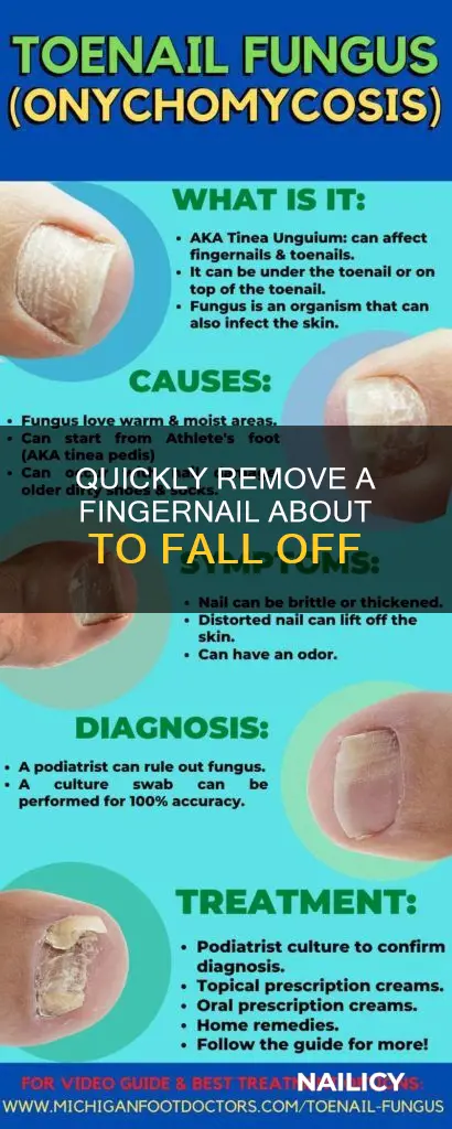 how to remove finger nail about to fall off