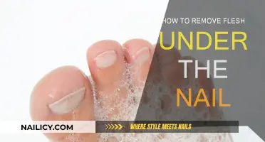 Effective Ways to Remove Flesh Stuck Under Nails