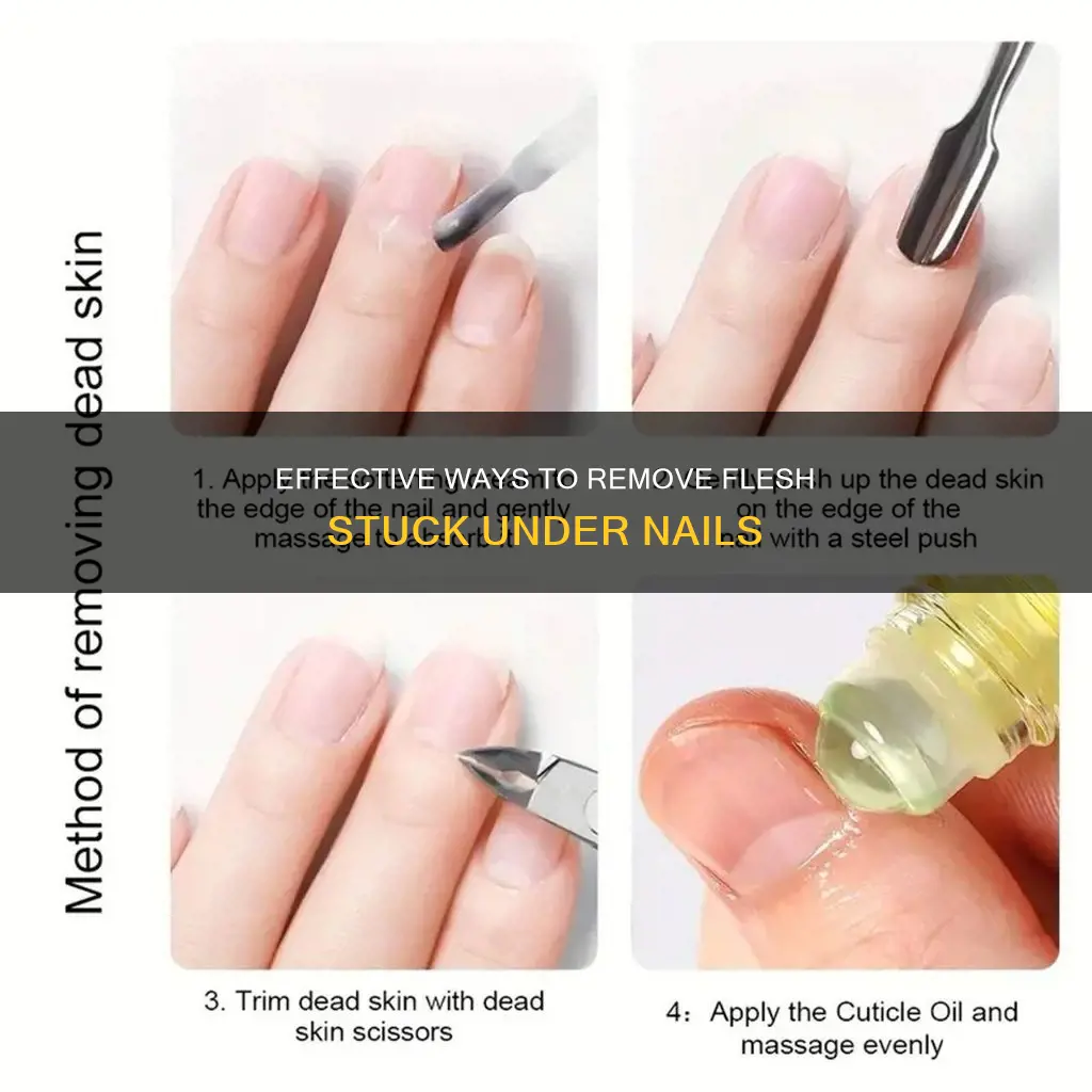 how to remove flesh under the nail