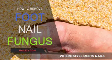 Effective Home Remedies for Toenail Fungus