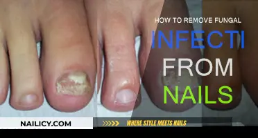 Natural Remedies for Nail Fungal Infections