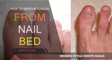Eradicating Nail Bed Fungus: A Comprehensive Guide