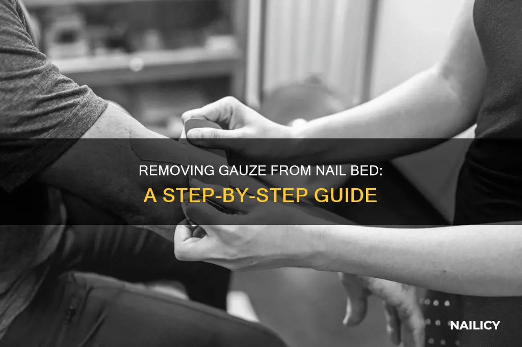 how to remove gauze from nail bed
