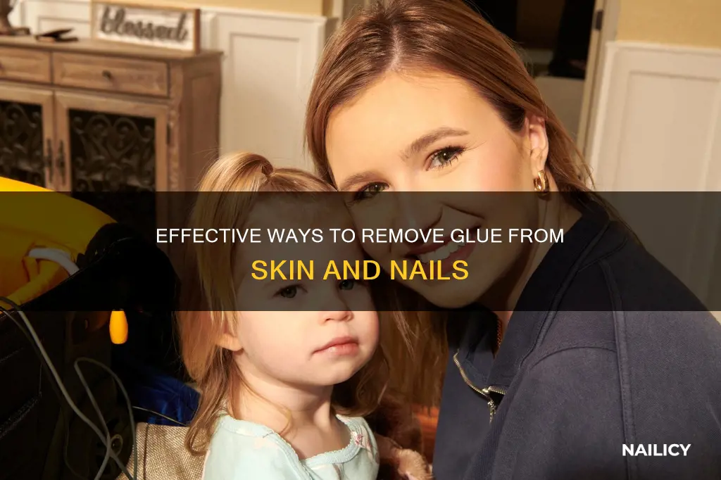 how to remove glue from skin and nails