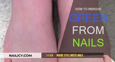 Get Rid of Green Nails: Easy Solutions