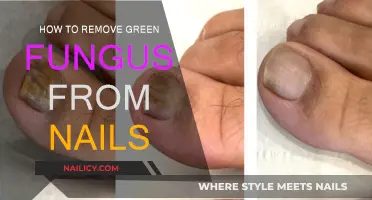 Eradicating Green Fungus from Nails: A Simple Guide