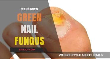 Get Rid of Green Nail Fungus