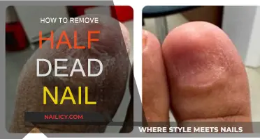 Easy Steps to Remove Half-Dead Nails