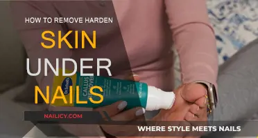 Get Rid of Hardened Skin Under Nails