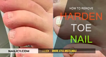 Effective Ways to Remove Hardened Toe Nails at Home