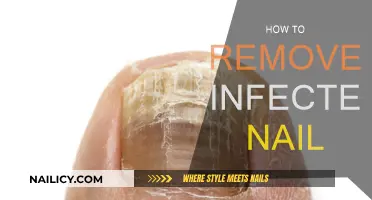 Effective Home Remedies for Treating an Infected Nail