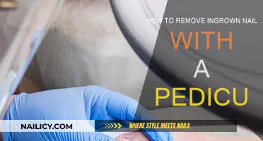 Pedicure Precision: Removing Ingrown Nails
