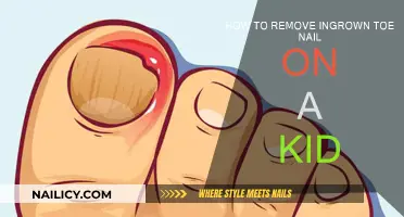 Easy Home Remedies for Ingrown Toenails in Kids