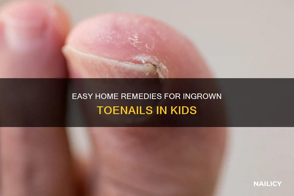 how to remove ingrown toe nail on a kid