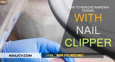 Clipper Solution: Ingrown Toenail Relief