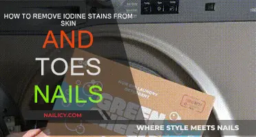 Get Rid of Iodine Stains on Skin and Toenails
